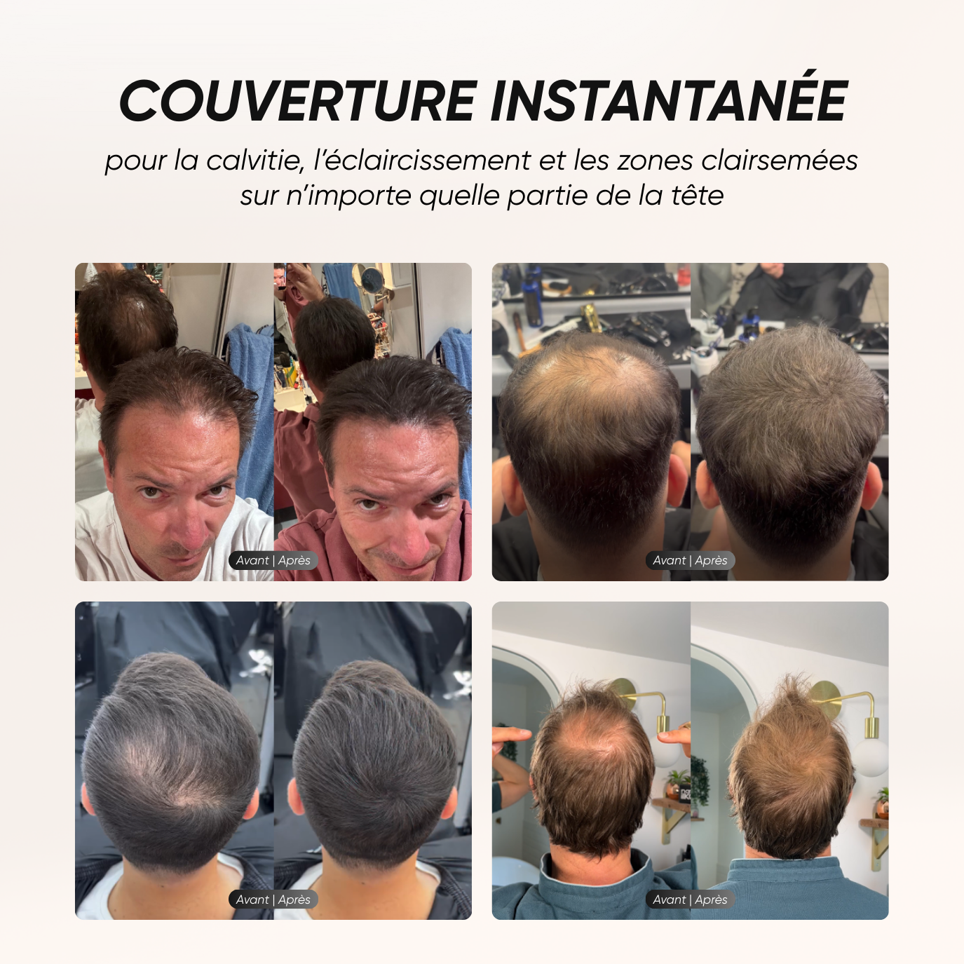 Camouflage capillaire