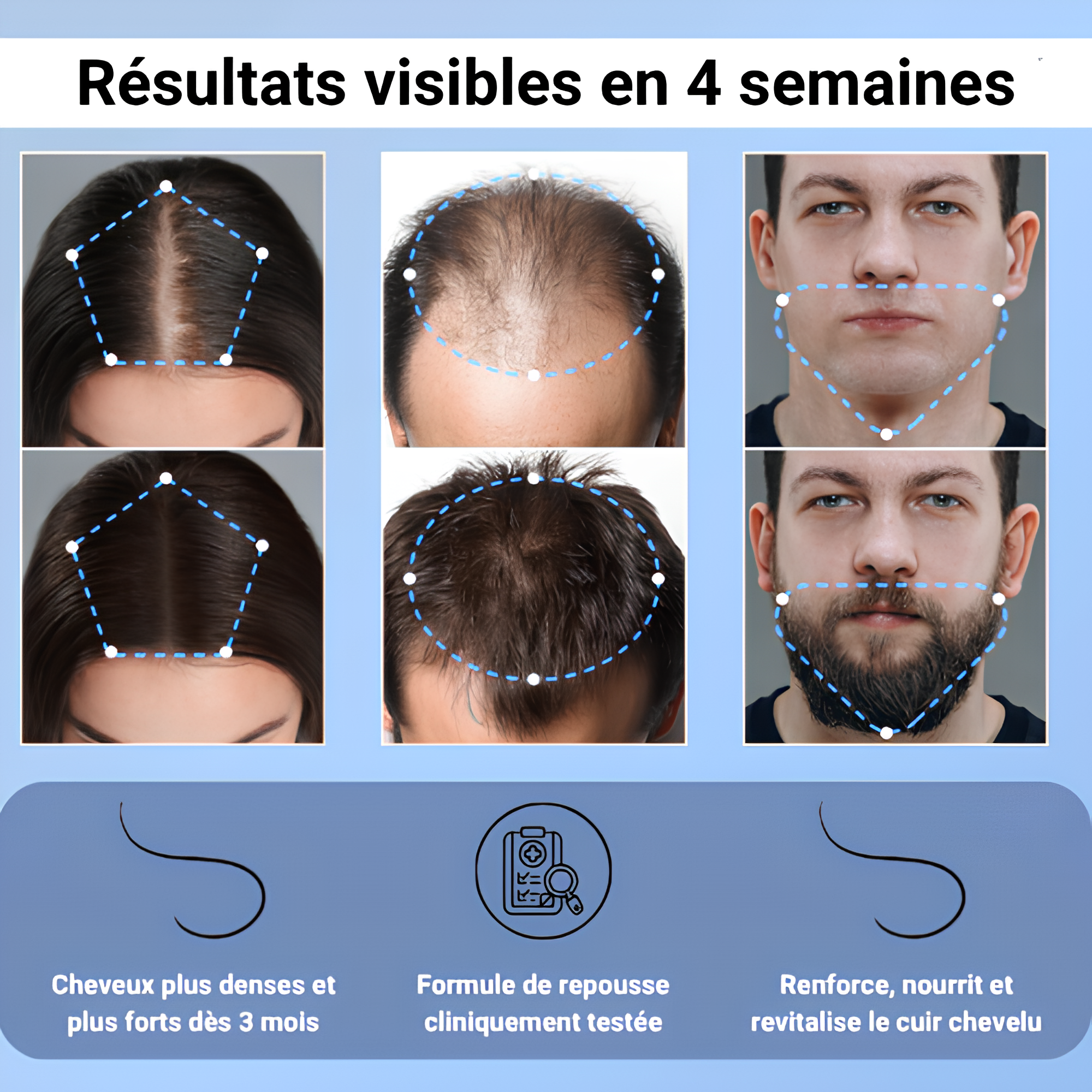 Activateur capillaire