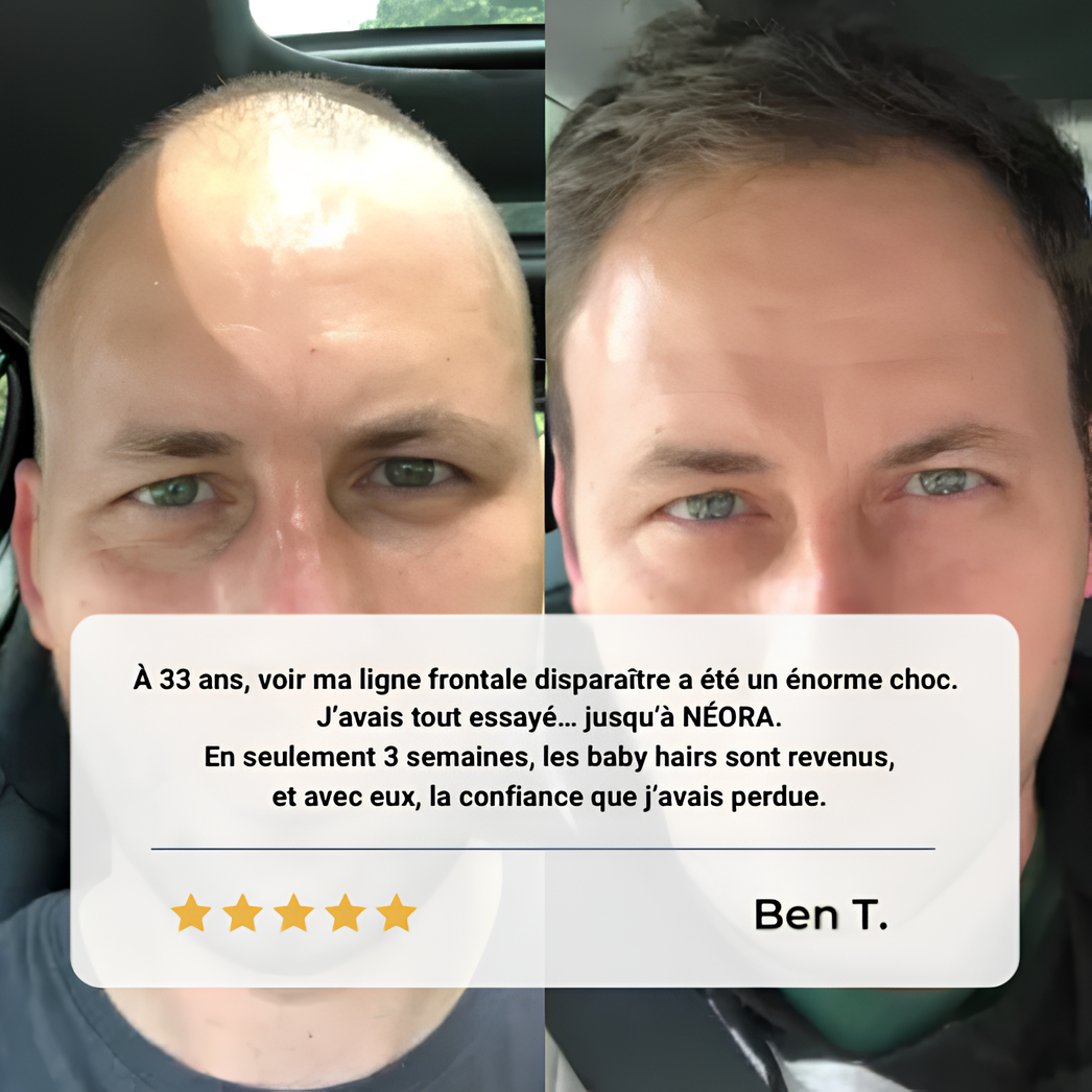 Activateur capillaire